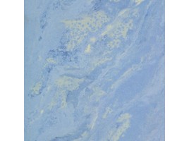 Gallery (Atlas Concorde Italy)